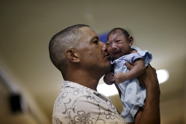 baby-born-microcephaly-brazil