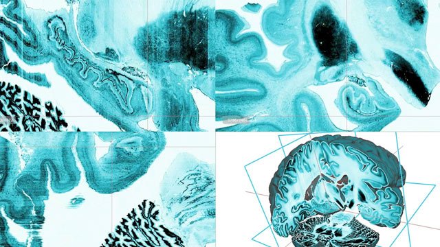 3D animation of the human brain