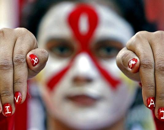 hiv positive