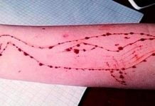 Blue whale suicide game