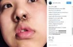 nose hair 1