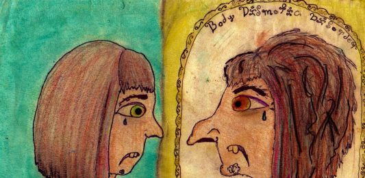 Body dysmorphic disorder