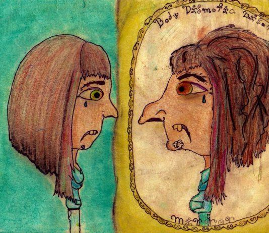 Body dysmorphic disorder