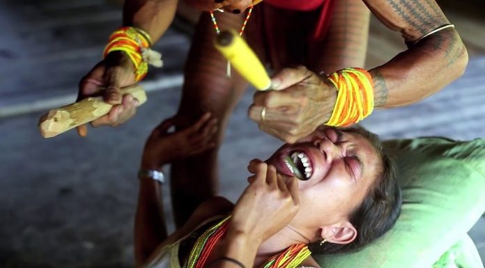 Women Made To Look Terrifying With A Beauty Tradition Of Making Teeth Look Like Needles