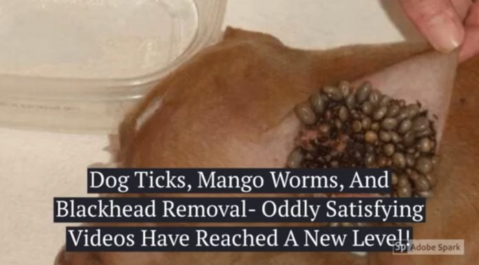 Watch: Dog Ticks, Mango Worms, And Blackhead Removal- Oddly Satisfying Videos Have Reached A New Level! ticks