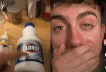 TikTok Challenge Goes Viral As Teens Press Bleach Packets On Their Eyes To Change The Eye Colour
