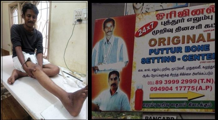 This Traditional, Ayurvedic Bone Setting Technique Is Still Preferred Over Modern Ways By Many In South