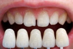 teeth
