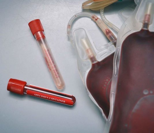 Will Using The Blood Of Recovered People Be Effective In Treating COVID-19 Patients Through Convalescent Plasma Therapy?