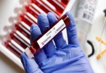 Which COVID-19 Test Should One Get Done, Costs, Procedure & More