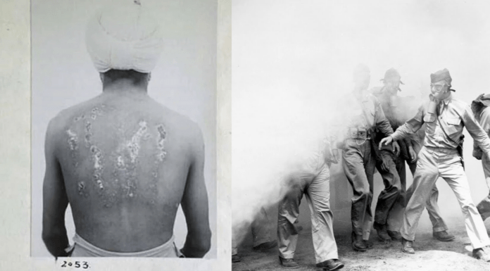 What Were The Cruel Rawalpindi Experiments Carried Out During WW2?