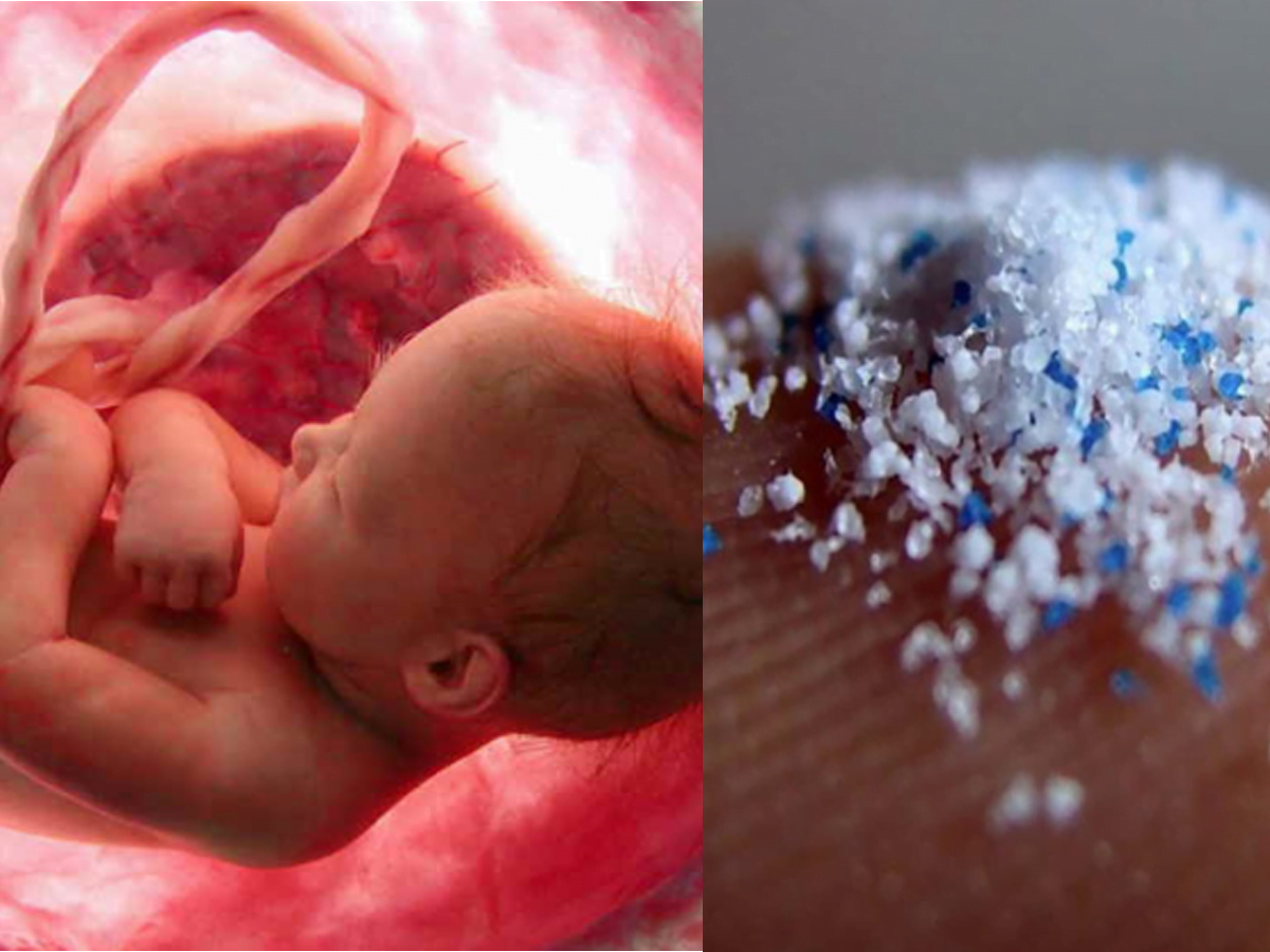 Placenta With Plastics: Microplastic Pollution Reaches The Unborn Babies