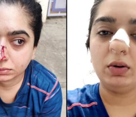 Woman Allegedly Attacked By Zomato Delivery Guy In Bangalore, Left With Bleeding Nose