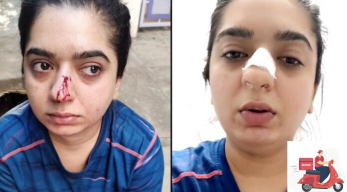 Woman Allegedly Attacked By Zomato Delivery Guy In Bangalore, Left With Bleeding Nose