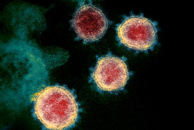Microscopic image of the Omicron virus