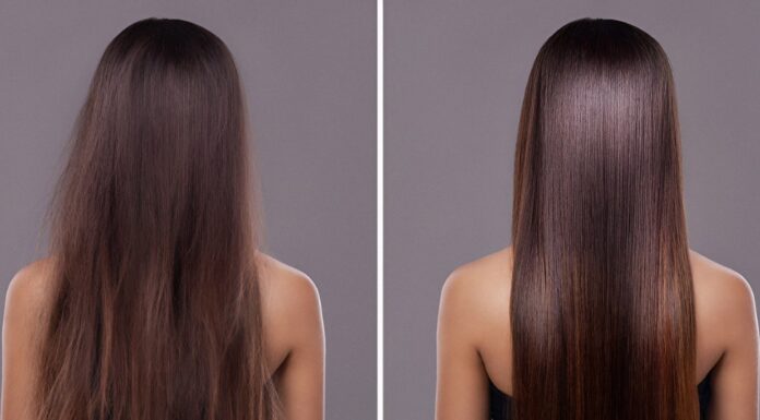 This Is How Hair Straightening And Kidney Failure Are Related straightening