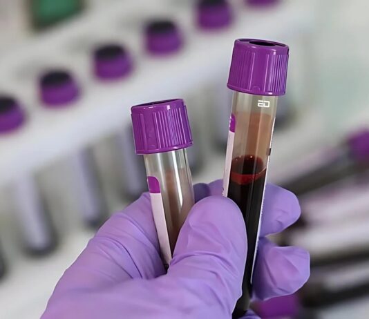 World’s Rarest Blood Group Is Not The One You Think: Here’s Why It’s So Unique blood group