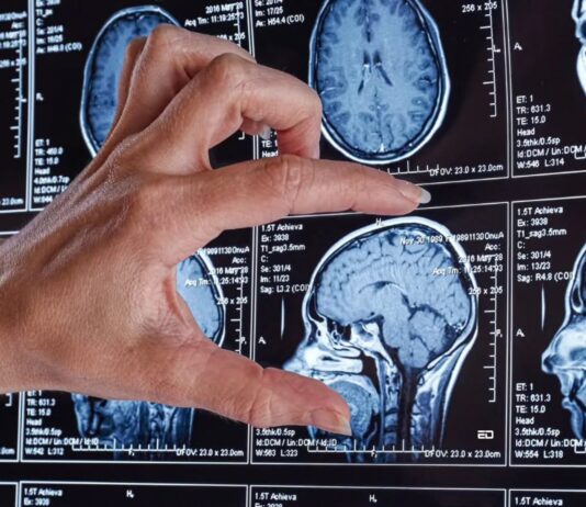 Study Reveals That Our Brain Becomes Adult Only After 32 brain