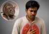 Is Hantavirus Dangerous And Can It Reach Us? Hantavirus